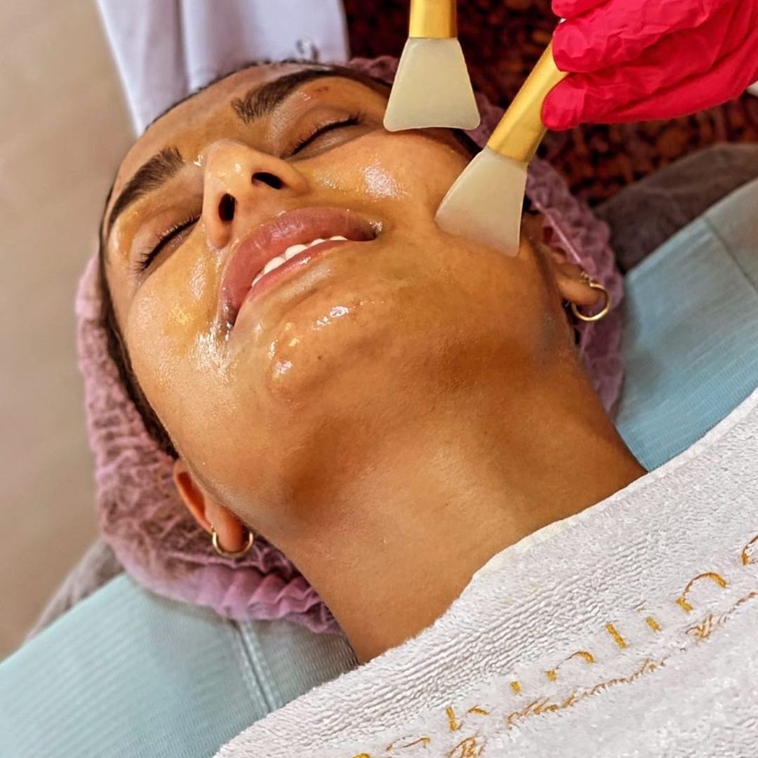 Read more about the article Fresh and younger skin with MesoSkinline! #mesoskinline #mesotherapy #skincare #bbglow #bbglowtreatment #antiagingskincare #perfectskin #perfectskinsu…