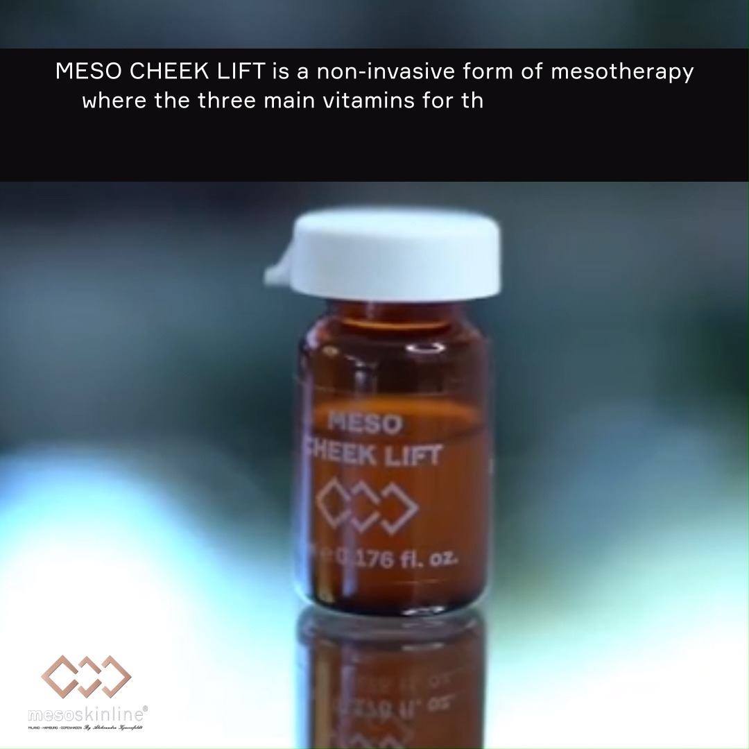 Read more about the article Meso Cheek Lift by Mesoskinline