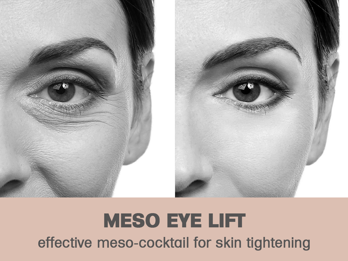 Read more about the article This product is truly amazing  It’s specially designed for the delicate area around the eyes and highly effective for damaged, mature and impure skin….